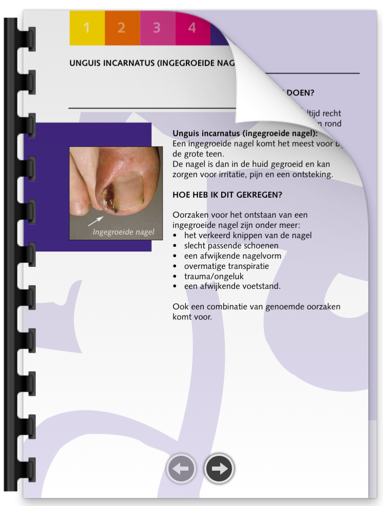 Ingegroeide nagel brochure | Podotherapie Eemland